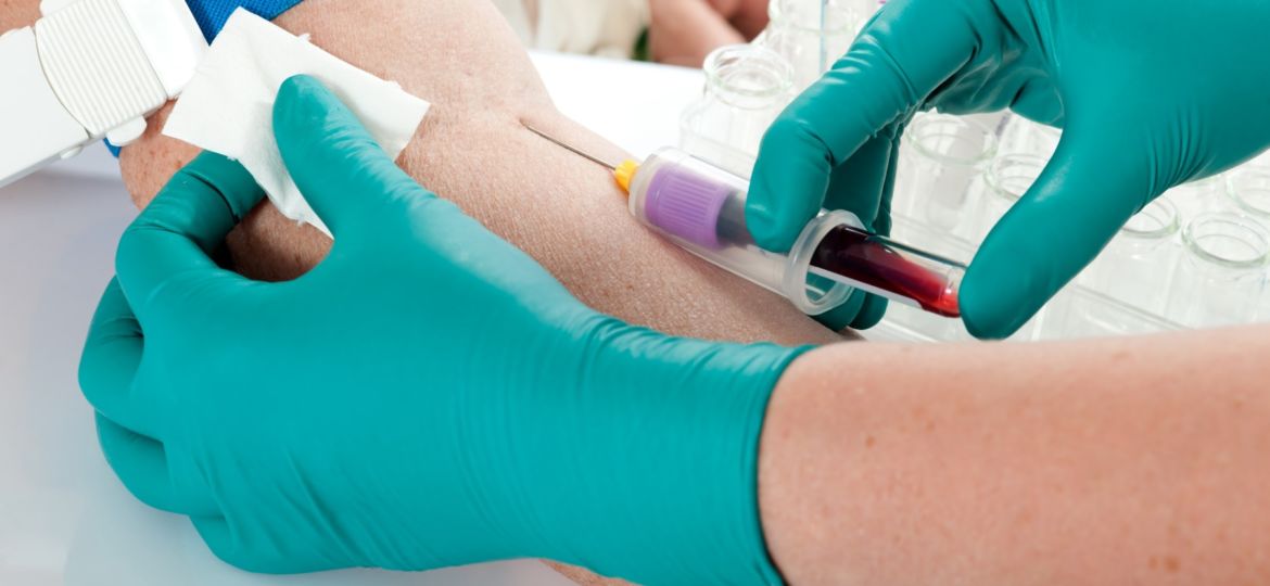 Platelet Picture